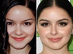 Ariel Winter Before and After Plastic Surgery