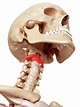 Human Axis Bone Photograph by Sebastian Kaulitzki/science Photo Library