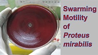 Swarming of Proteus mirabilis on Blood Agar - YouTube