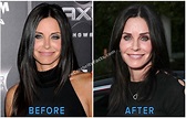 Courteney Cox's plastic surgery removal reveals a new natural face