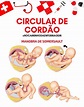 Circular de cordão : Manobra de Somersault - Neonatologia e Obstetricia