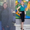 Weight Loss Surgery Before & After Photos - Soma Bariatrics Los Angeles