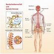 Rückenschmerzen - Orthopädische Praxis Dr. med. Arthecker