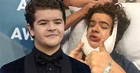 How Gaten Matarazzo Fixed His Teeth And The Truth About His Condition