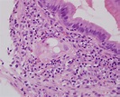Histopathology Reviewed - Peeriodicals