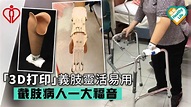 「3D打印」義肢靈活易用 截肢病人一大福音 - 晴報 - 專欄 - 健康 - 醫院管理局 - D190823