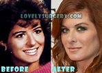 Debra Messing Plastic Surgery Before and After Pictures - Lovely Surgery