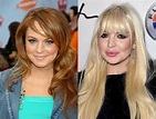 Lindsay Lohan Before and After Plastic Surgery