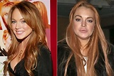 Lindsay Lohan Plastic Surgery Pictures