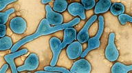 Virus de Marburgo: qué es, cómo se trasmite y cómo prevenir la ...