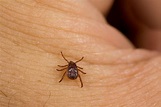 Seed Ticks on Humans