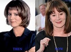 Patricia Richardson Plastic Surgery Photo Before and After - CELEB ...