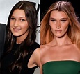 Bella Hadid plastic surgery: Before and after | WHO Magazine