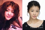 hey hey hey: [ Lee Si Young ] Before & After Plastic Surgery