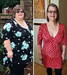 People Who Lost A Lot Of Weight Are Sharing Before And After Pics And ...