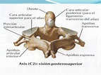 Anatomía topográfica de la columna vertebral