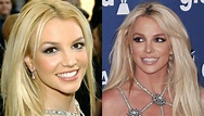 Cirujano plástico analiza el rostro de Britney Spears antes y después