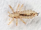What Do Lice Look Like? Pictures of Nits, Eggs, and Lice