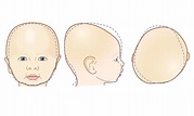 Infant head deformity explained | Time Out Abu Dhabi