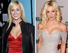 Kellie Pickler Plastic Surgery Before and After - Celebrity Plastic Surgery
