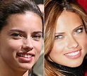 Adriana Lima before and after plastic surgery 16 – Celebrity plastic ...