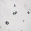 Entamoeba histolytica Trophozoites, Smear Microscope Slide: Microscope ...