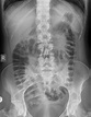 kub x ray anatomy