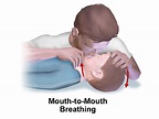 mouth to mouth | RLS HUMAN CARE