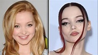 Dove Cameron Before And After: Good Mourning Actress Sparks Plastic ...