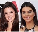 Kendall Jenner before and after | Kendall jenner nose job, Kendall ...