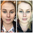 Face Before And After Weight Loss Female - WeightLossLook