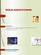 Mola Hidatiforme | PDF | El embarazo | Quimioterapia