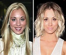 Kaley Cuoco: Plastic surgery best thing I’ve ever done | Woman's Day
