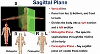 Body Planes and Sections: Anatomical Position, Directional Term ...