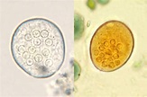 Entamoeba coli Cysts Smear Microscope Slide