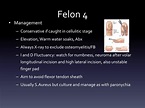 PPT - HAND INFECTIONS PowerPoint Presentation - ID:4624020