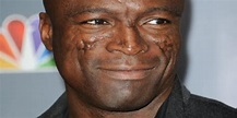 What Is Wrong with Seals Face: The Struggle Behind Singer Seal's ...