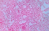 File:Gram negative bacilli.jpg - Wikimedia Commons