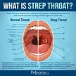 Strep Throat: Symptoms and 15 Natural Support Strategies