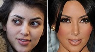 Celebrities Without Makeup Before After | Saubhaya Makeup