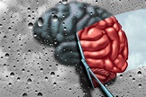 What's the Impact of Drugs on Your Brain | FindRehabCenters.org