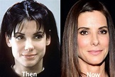 Sandra Bullock Plastic Surgery: Cheek Filler, Nose Job, Facelift