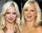 Anna Faris before and after plastic surgery 08 – Celebrity plastic ...