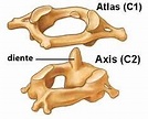 HUESOS ATLAS Y AXIS: Características.