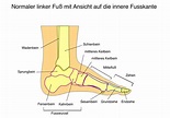 Info Behandlungen Fußschmerzen | Dr. Thomas Hartmann