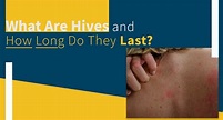 What Are Hives and How Long Do They Last? | Valley Skin Institute