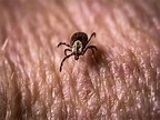 Rocky Mountain Spotted Fever: 10 Symptoms of Rocky Mountain Spotted Fever