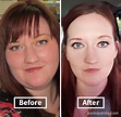 Weight Loss Before And After Face Changes - BMI Formula