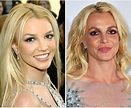 Britney Spears Before and After Plastic Surgery Reveals Her Popstar ...
