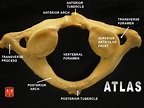 Atlas vertebrae - Atlas (anatomy) - Wikipedia | Atlas anatomy, Anatomy ...